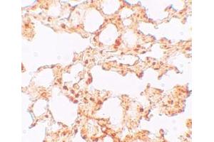 Immunohistochemistry (IHC) image for anti-Solute Carrier Family 39 (Zinc Transporter), Member 6 (SLC39A6) (Middle Region) antibody (ABIN1031182)