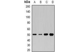 Image no. 3 for anti-Molybdenum Cofactor Synthesis 3 (MOCS3) (full length) antibody (ABIN6004446)