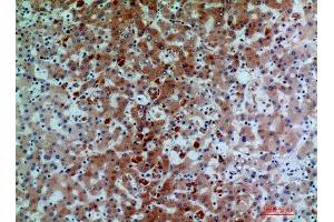 Image no. 3 for anti-Complement Component C7 (C7) antibody (ABIN3181728)