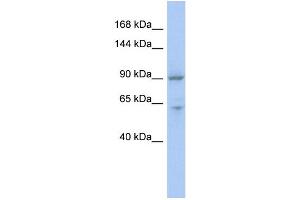 Image no. 1 for anti-MLX Interacting Protein (MLXIP) (Middle Region) antibody (ABIN2776519)