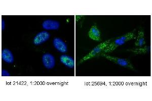 Image no. 7 for anti-Telomerase Reverse Transcriptase (TERT) (C-Term) antibody (ABIN6655270)