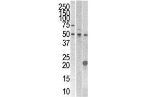 Image no. 1 for anti-serine/threonine/tyrosine Kinase 1 (STYK1) (AA 31-64) antibody (ABIN3032543)