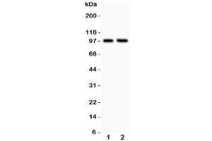 Western blot testing of LFA-1 antibody and Lane 1:  Jurkat;  2: CEM;  Predicted/Observed size: 85~95KD depending on glycosylation level