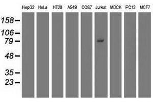 Image no. 2 for anti-Tripartite Motif Containing 2 (TRIM2) (AA 1-100), (AA 1500-1600) antibody (ABIN1490539)