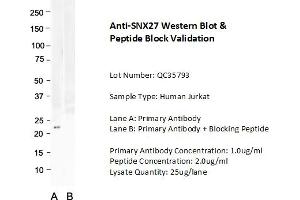 Image no. 1 for anti-Sorting Nexin 27 (SNX27) (C-Term) antibody (ABIN2790135)