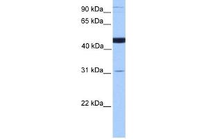 Image no. 1 for anti-Saccharopine Dehydrogenase (SCCPDH) (C-Term) antibody (ABIN2785530)