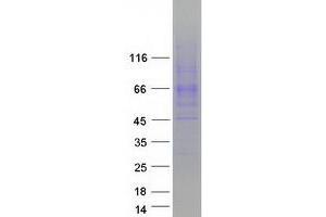 Image no. 1 for Solute Carrier Family 6 (Neurotransmitter Transporter, serotonin), Member 4 (SLC6A4) protein (Myc-DYKDDDDK Tag) (ABIN2732177)