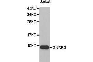 Image no. 1 for anti-Small Nuclear Ribonucleoprotein Polypeptide G (SNRPG) antibody (ABIN1682846)