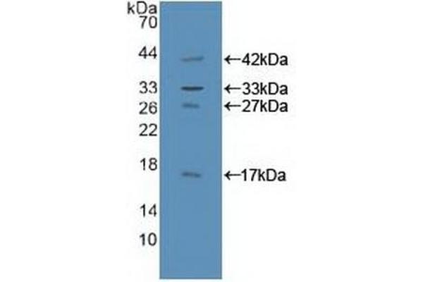 GAB1 Antikörper  (AA 394-656)