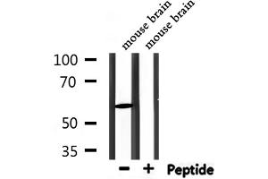 Image no. 1 for anti-Pyruvate Dehyrogenase Phosphatase Catalytic Subunit 2 (PDP2) (N-Term) antibody (ABIN6258477)