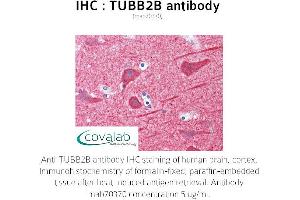 Image no. 1 for anti-Tubulin, beta 2B (TUBB2B) antibody (ABIN1724373)