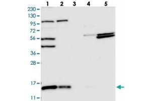 Image no. 1 for anti-Family with Sequence Similarity 136, Member A (FAM136A) antibody (ABIN5577757)