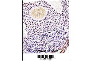 Image no. 1 for anti-WEE1 Homolog 2 (S. Pombe) (WEE2) (Center) antibody (ABIN2494090)
