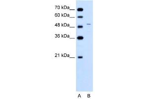 Image no. 3 for anti-Ferrochelatase (FECH) (N-Term) antibody (ABIN2777033)