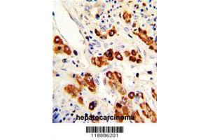 Image no. 2 for anti-Carcinoembryonic Antigen-Related Cell Adhesion Molecule 5 (CEACAM5) (AA 50-77), (N-Term) antibody (ABIN391544)