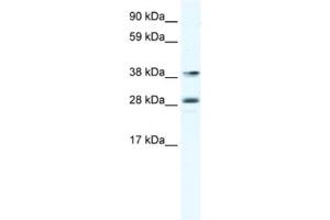 Image no. 1 for anti-Myocyte Enhancer Factor 2B (MEF2B) antibody (ABIN2461444)