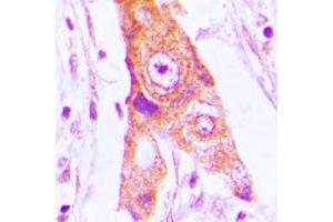anti-Mitochondrial Ribosomal Protein L46 (MRPL46) (Center) antibody