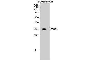 Image no. 1 for anti-Insulin-Like Growth Factor Binding Protein 3 (IGFBP3) (Ser53) antibody (ABIN3185137)