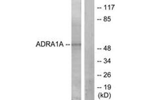 Image no. 1 for anti-Adrenoceptor alpha 1A (ADRA1A) (AA 341-390) antibody (ABIN1534250)