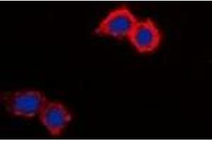 Image no. 3 for anti-Solute Carrier Family 9 (Sodium/hydrogen Exchanger), Member 8 (SLC9A8) (C-Term) antibody (ABIN2801284)