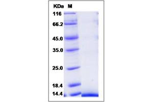 Image no. 1 for Chemokine (C-C Motif) Ligand 27 (CCL27) (AA 25-112) protein (His tag) (ABIN2003159)