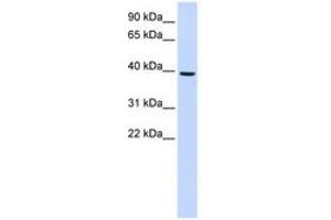 Image no. 1 for anti-Monoacylglycerol O-Acyltransferase 2 (MOGAT2) (AA 180-229) antibody (ABIN6741070)