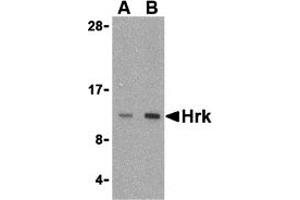 Western Blotting (WB) image for anti-Harakiri, BCL2 Interacting Protein (Contains Only BH3 Domain) (HRK) (Middle Region) antibody (ABIN1030949)
