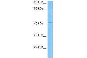 Image no. 2 for anti-Interleukin 11 Receptor, alpha (IL11RA) (N-Term) antibody (ABIN2782643)