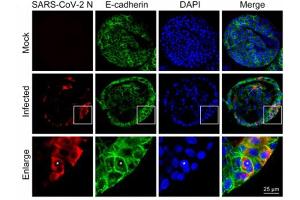 Immunofluorescence of Rabbit Anti-SARS-CoV Nucleocapsid (N) Antibody.