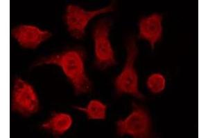 Image no. 3 for anti-Tumor Protein P63 (TP63) (C-Term) antibody (ABIN6263986)
