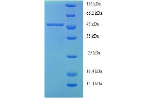 Image no. 1 for Alanine Glyoxylate Aminotransferase (AGXT) (AA 1-392), (full length) protein (His tag) (ABIN5709013)