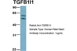 Image no. 7 for anti-Transforming Growth Factor beta 1 Induced Transcript 1 (TGFB1I1) (Middle Region) antibody (ABIN2777947)