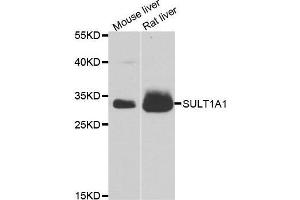 Image no. 1 for anti-Sulfotransferase Family, Cytosolic, 1A, Phenol-Preferring, Member 1 (SULT1A1) antibody (ABIN3022214)