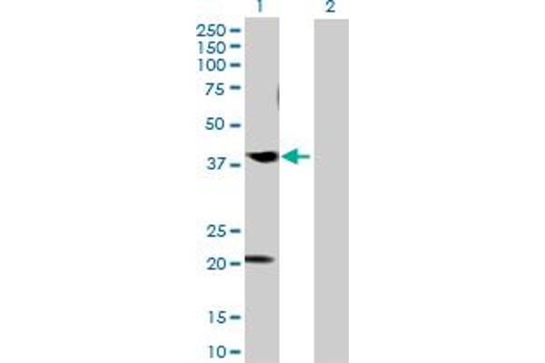 anti-Cdk5 and Abl Enzyme Substrate 1 (CABLES1) (AA 1-368) antibody