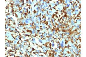 Image no. 3 for anti-Coagulation Factor XIII, A1 Polypeptide (F13A1) (AA 46-181) antibody (ABIN6939361)