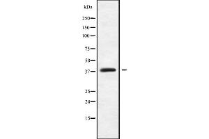 Image no. 1 for anti-Melanoma Antigen Family B, 18 (MAGEB18) (Internal Region) antibody (ABIN6263068)