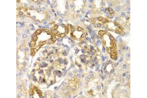 Immunohistochemistry of paraffin-embedded Rat kidney using ASC / TMS1 Polyclonal Antibody at dilution of 1:100 (40x lens).