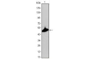 Image no. 1 for anti-Keratin 15 (KRT15) antibody (ABIN1106913)