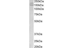 Image no. 1 for anti-A Kinase (PRKA) Anchor Protein 12 (AKAP12) (C-Term) antibody (ABIN5539465)