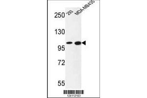 Image no. 1 for anti-Nuclear Receptor Coactivator 7 (NCOA7) (AA 76-103), (N-Term) antibody (ABIN653488)