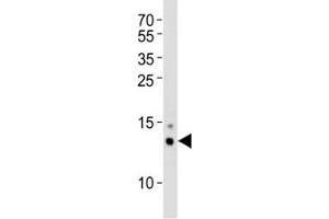 Image no. 1 for anti-Small Ubiquitin Related Modifier Protein 1 (SUMO1) (AA 1-30) antibody (ABIN3032639)