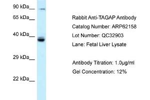 Image no. 1 for anti-T-Cell Activation rho GTPase-Activating Protein (TAGAP) (N-Term) antibody (ABIN2789039)
