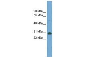 Image no. 1 for anti-TGFB-Induced Factor Homeobox 2-Like, X-Linked (TGIF2LX) (AA 101-150) antibody (ABIN6744629)