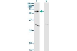 Image no. 7 for anti-V-Akt Murine Thymoma Viral Oncogene Homolog 1 (AKT1) (AA 1-480) antibody (ABIN559829)