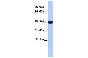 Image no. 1 for anti-LIM Homeobox Transcription Factor 1, alpha (LMX1A) (N-Term) antibody (ABIN2779793)