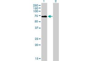 Image no. 3 for anti-Coagulation Factor II (thrombin) (F2) (AA 263-362) antibody (ABIN560822)