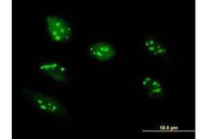 Image no. 2 for anti-RRS1 Ribosome Biogenesis Regulator (RRS1) (AA 1-365) antibody (ABIN525030)