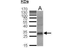 Image no. 4 for anti-Cyclin-Dependent Kinase Inhibitor 1B (p27, Kip1) (CDKN1B) (Center) antibody (ABIN2854753)