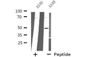 Western blot analysis of extracts from A549 cells using CHRNA10 antibody.