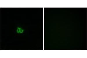 Image no. 3 for anti-Stathmin 1 (STMN1) (AA 5-54), (pSer16) antibody (ABIN1531981)